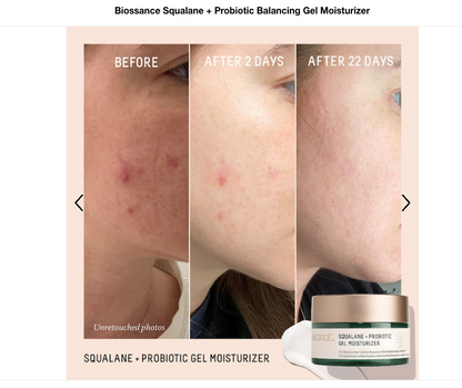 Biossance Squalane + Probiotic Gel Moisturizer